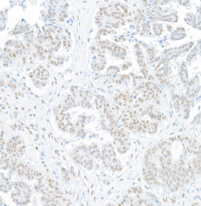 BRG1/SMARCA4 Antibody in Immunohistochemistry (Paraffin) (IHC (P))