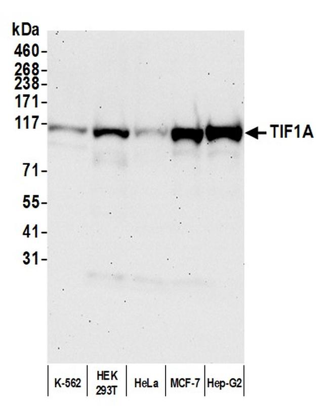 TIF1 Alpha/TRIM24 Antibody in Western Blot (WB)