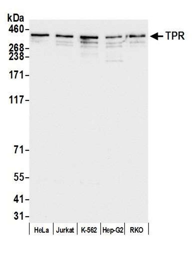 TPR Antibody in Western Blot (WB)