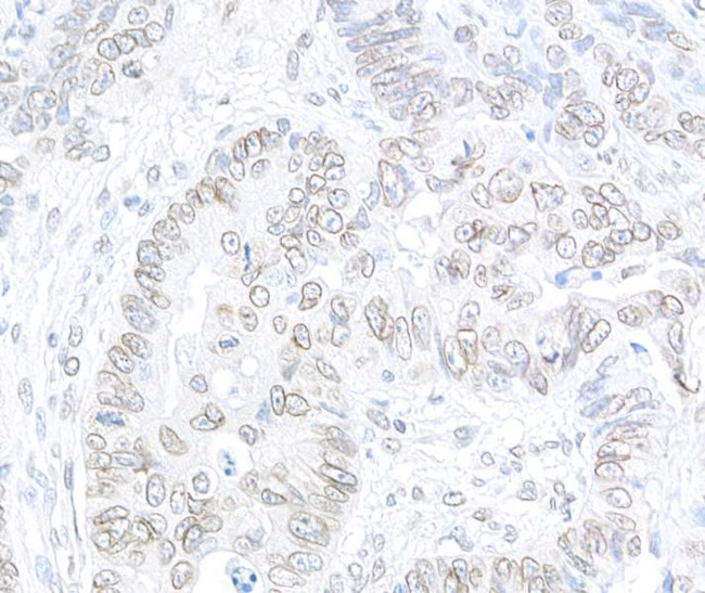 TPR Antibody in Immunohistochemistry (Paraffin) (IHC (P))