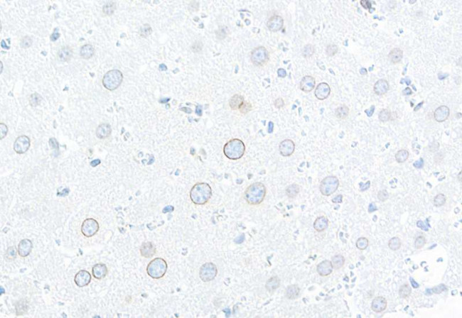 TPR Antibody in Immunohistochemistry (Paraffin) (IHC (P))