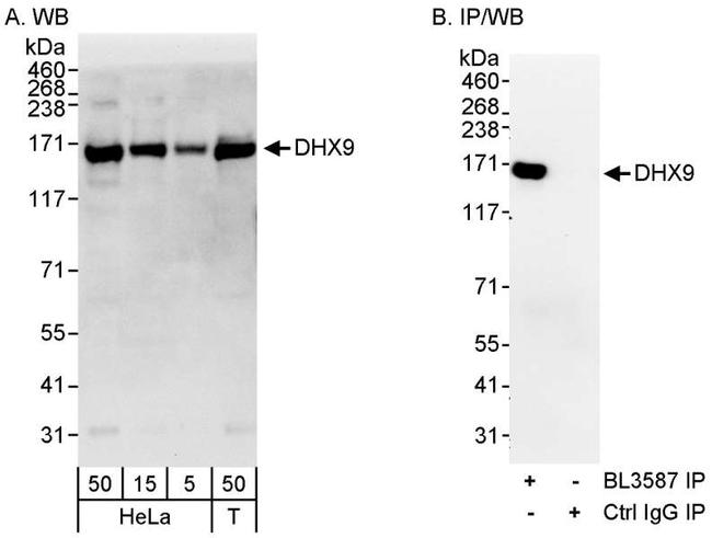 DHX9 Antibody in Western Blot (WB)