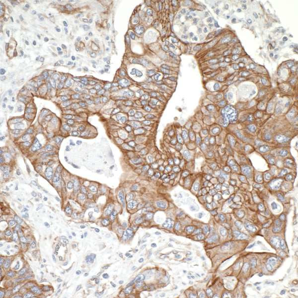 SPTBN1 Antibody in Immunohistochemistry (Paraffin) (IHC (P))