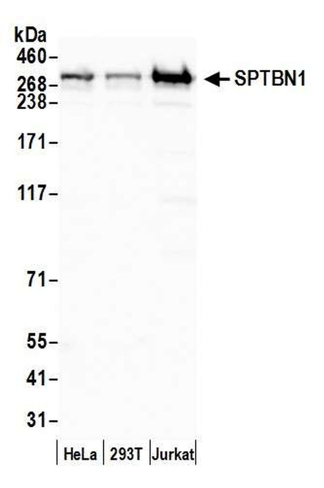 SPTBN1 Antibody in Western Blot (WB)