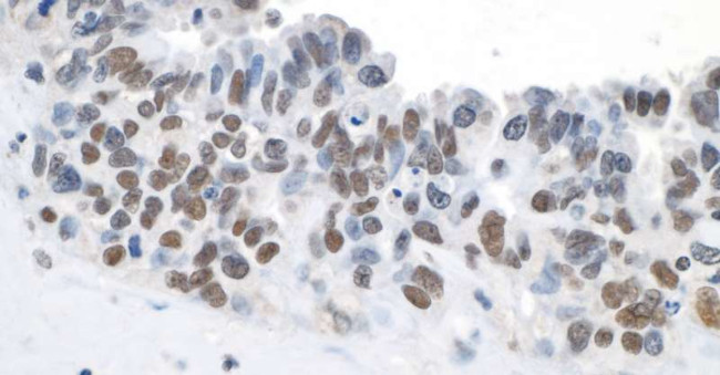 Topo II Beta Antibody in Immunohistochemistry (Paraffin) (IHC (P))