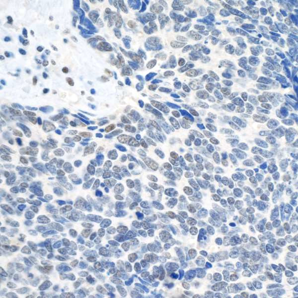 Topo II Beta Antibody in Immunohistochemistry (Paraffin) (IHC (P))