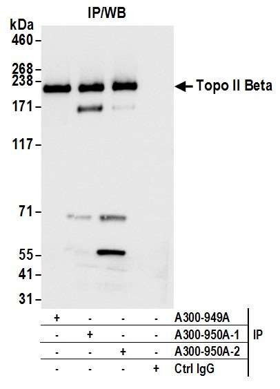 Topo II Beta Antibody in Immunoprecipitation (IP)