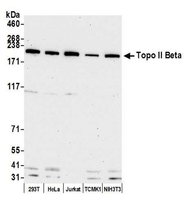 Topo II Beta Antibody in Western Blot (WB)