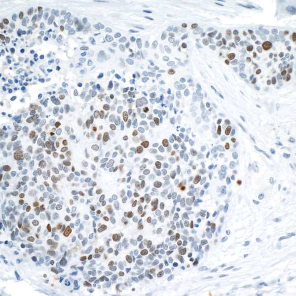 FALZ/BPTF Antibody in Immunohistochemistry (Paraffin) (IHC (P))