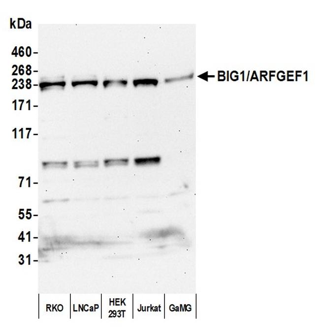 BIG1/ARFGEF1 Antibody in Western Blot (WB)