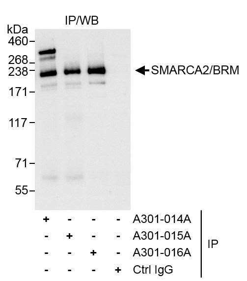 SMARCA2/BRM Antibody in Immunoprecipitation (IP)