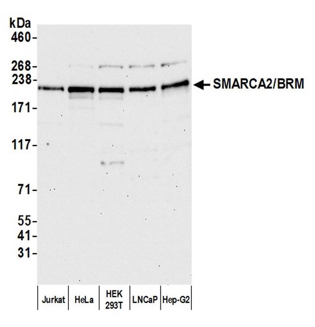 SMARCA2/BRM Antibody in Western Blot (WB)