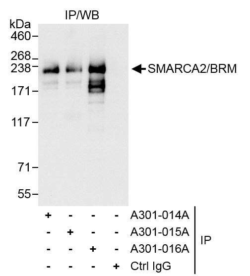 SMARCA2/BRM Antibody in Immunoprecipitation (IP)