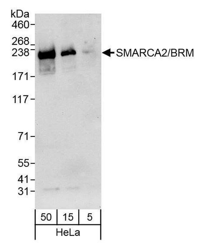 SMARCA2/BRM Antibody in Western Blot (WB)