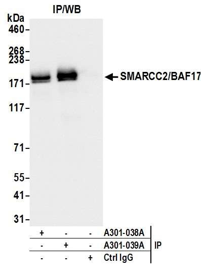 SMARCC2/BAF170 Antibody in Immunoprecipitation (IP)