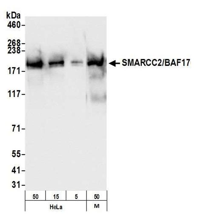 SMARCC2/BAF170 Antibody in Western Blot (WB)