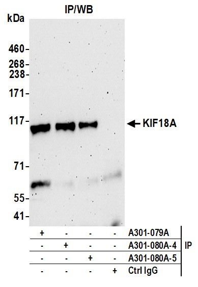 KIF18A Antibody in Immunoprecipitation (IP)