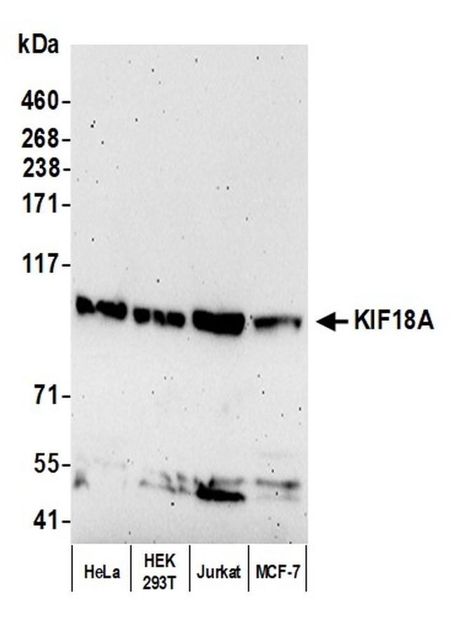 KIF18A Antibody in Western Blot (WB)