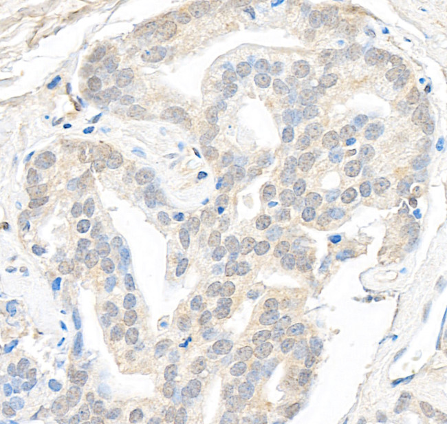 SMARCB1/SNF5 Antibody in Immunohistochemistry (Paraffin) (IHC (P))