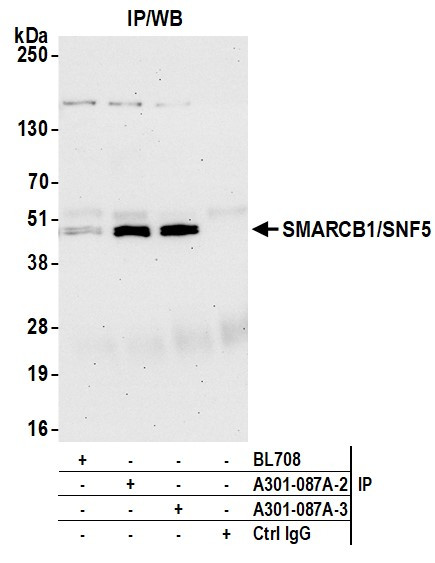 SMARCB1/SNF5 Antibody in Immunoprecipitation (IP)