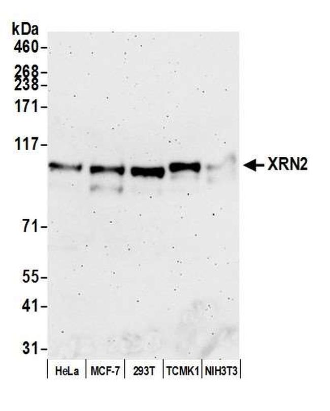 XRN2 Antibody in Western Blot (WB)