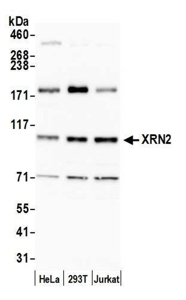 XRN2 Antibody in Western Blot (WB)