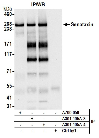 Senataxin Antibody in Immunoprecipitation (IP)