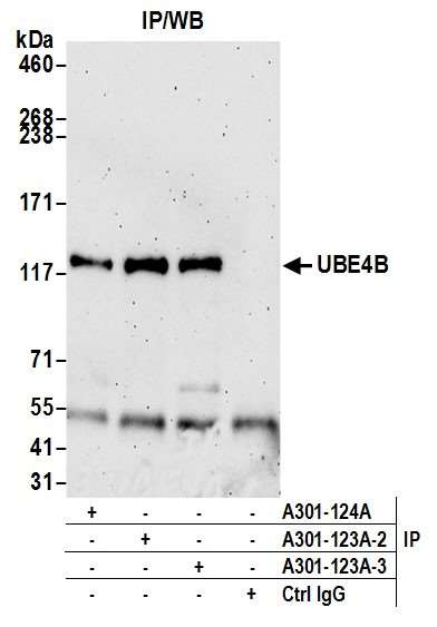 UBE4B Antibody in Immunoprecipitation (IP)