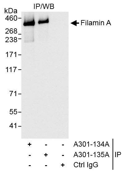 Filamin A Antibody in Immunoprecipitation (IP)