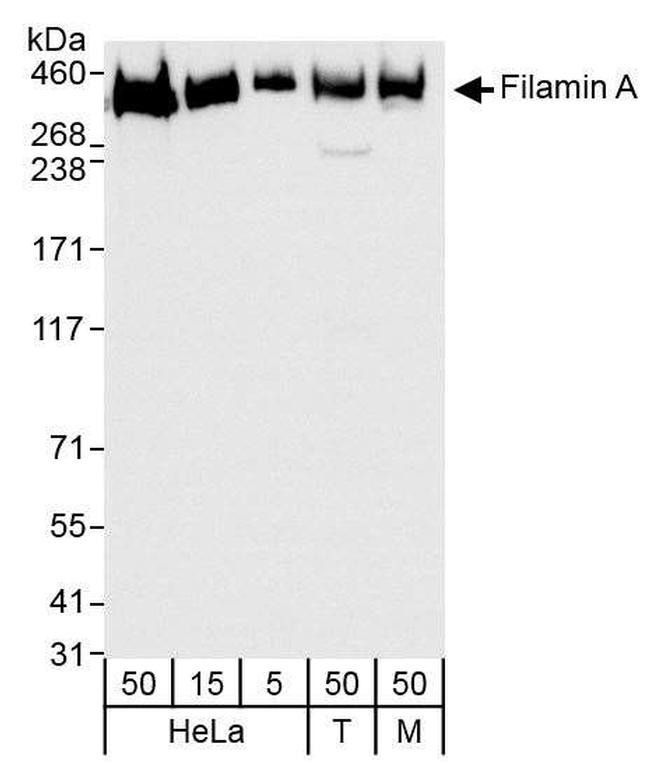 Filamin A Antibody in Western Blot (WB)