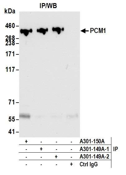 PCM1 Antibody in Immunoprecipitation (IP)