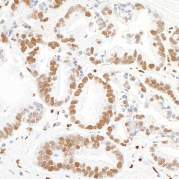 PML Antibody in Immunohistochemistry (Paraffin) (IHC (P))