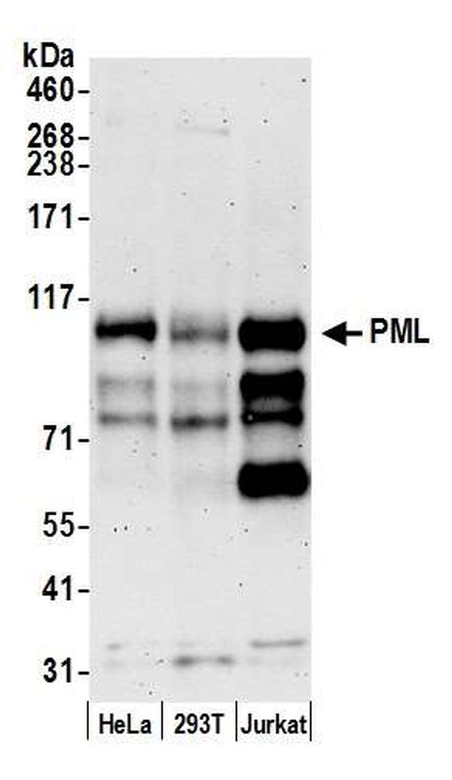 PML Antibody in Western Blot (WB)