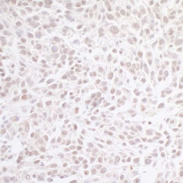 CHD8 Antibody in Immunohistochemistry (Paraffin) (IHC (P))