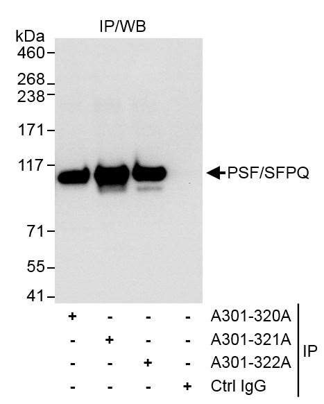 PSF/SFPQ Antibody in Immunoprecipitation (IP)