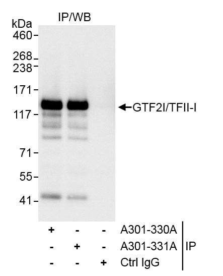 GTF2I/TFII-I Antibody in Immunoprecipitation (IP)