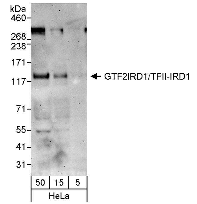 GTF2IRD/TFII-IRD1 Antibody in Western Blot (WB)