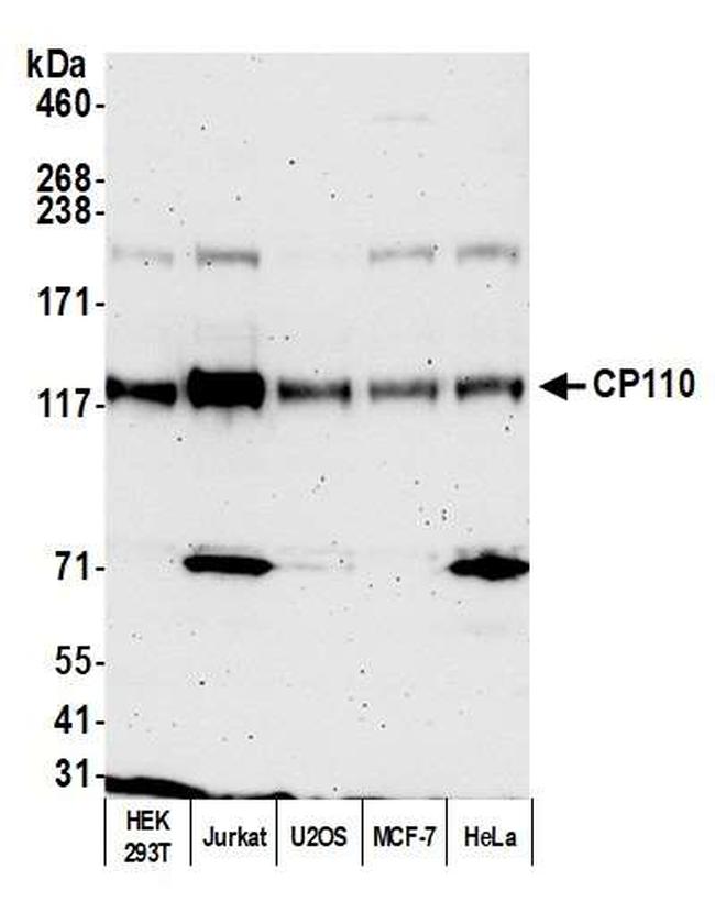 CP110 Antibody in Western Blot (WB)