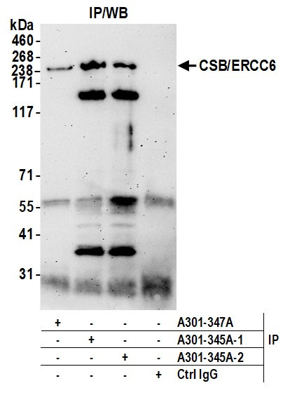 CSB/ERCC6 Antibody in Immunoprecipitation (IP)