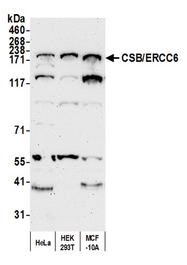 CSB/ERCC6 Antibody in Western Blot (WB)