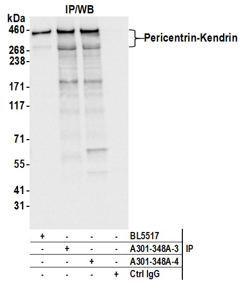 Pericentrin/Kendrin Antibody in Immunoprecipitation (IP)