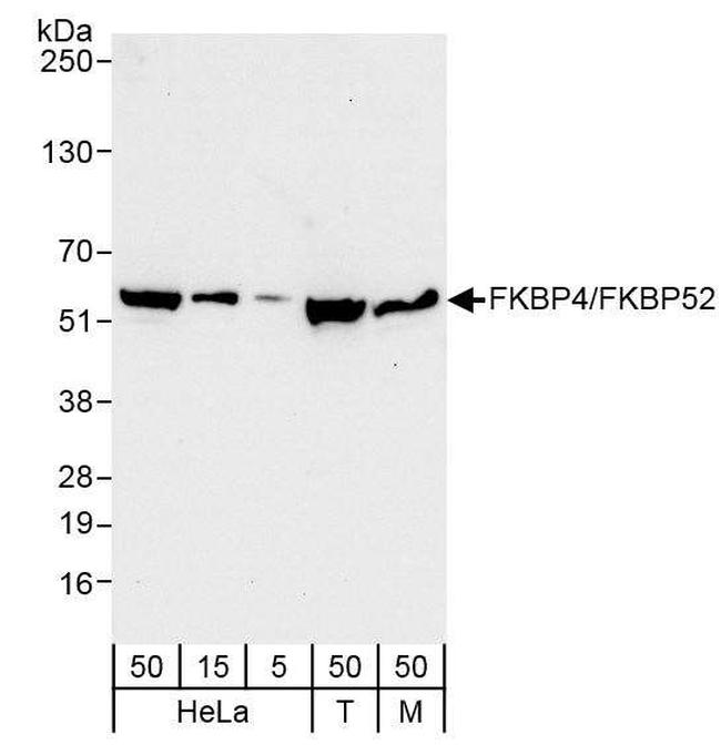 FKBP4/FKBP52 Antibody in Western Blot (WB)