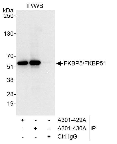 FKBP5/FKBP51 Antibody in Immunoprecipitation (IP)