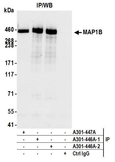 MAP1B Antibody in Immunoprecipitation (IP)