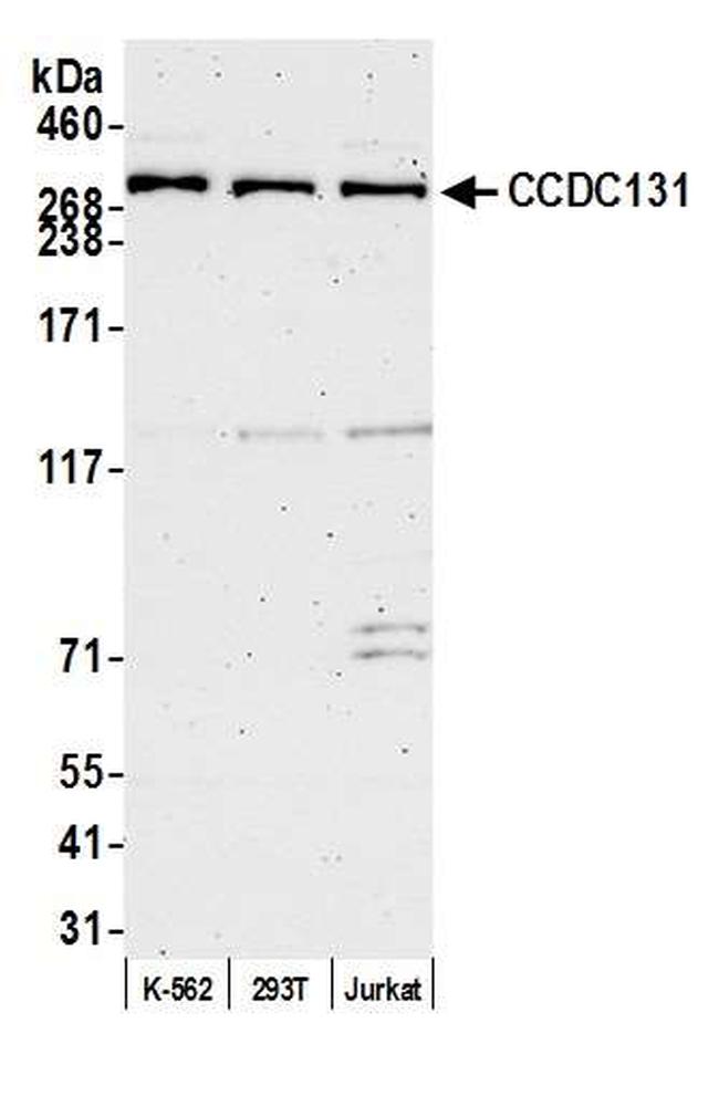 CCDC131 Antibody in Western Blot (WB)