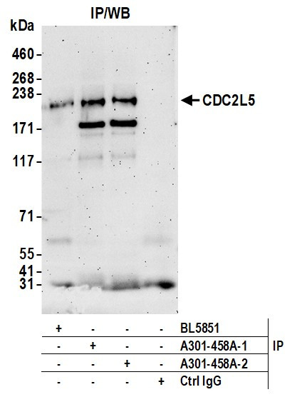 CDC2L5 Antibody in Immunoprecipitation (IP)