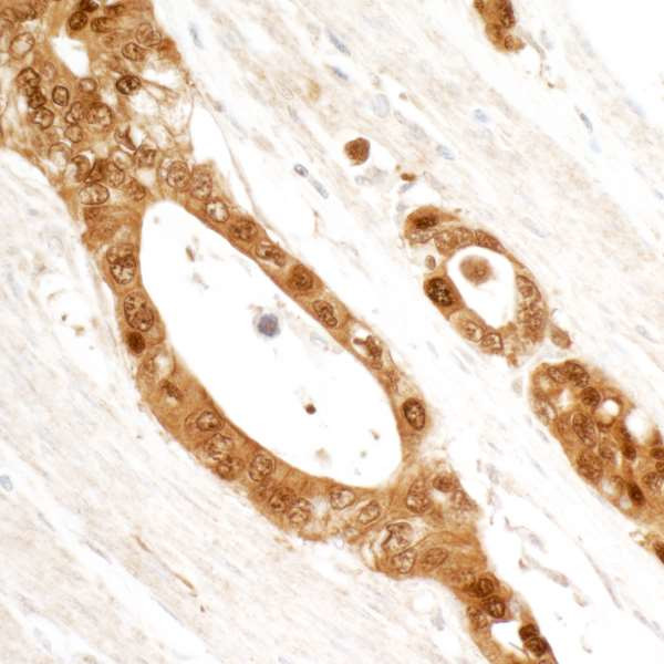 14-3-3 Sigma Antibody in Immunohistochemistry (Paraffin) (IHC (P))