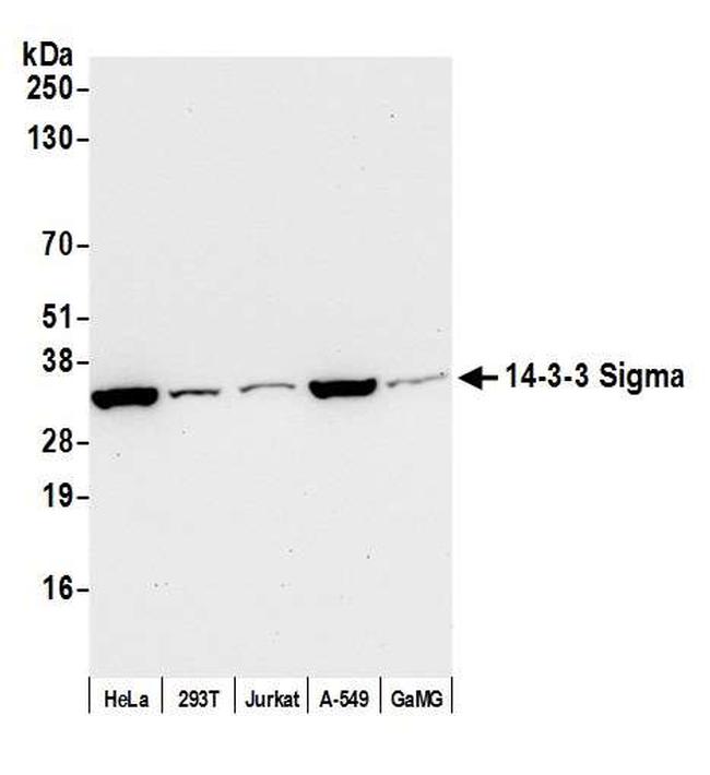 14-3-3 Sigma Antibody in Western Blot (WB)