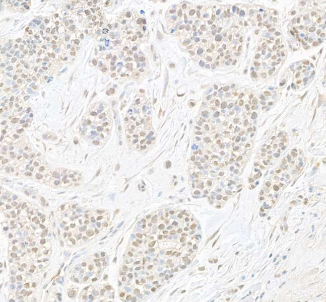 B-Myb Antibody in Immunohistochemistry (Paraffin) (IHC (P))