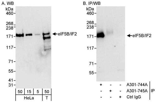 eIF5B/IF2 Antibody in Western Blot (WB)